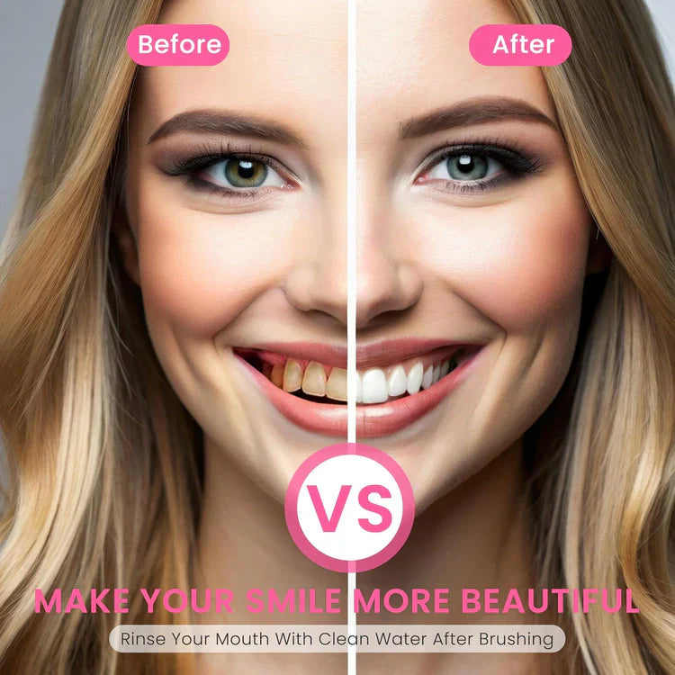 🏆【Max】TLOPA® Nicotinamide Toothpaste【💎New upgrade Powerful type 10% concentration of Nicotinamide】