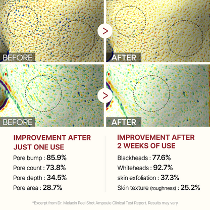 🚨 FLASH SALE: Upgrade to VIP NOW – 50% Off ⏳ (Only 72 Hours Left!) 🔥