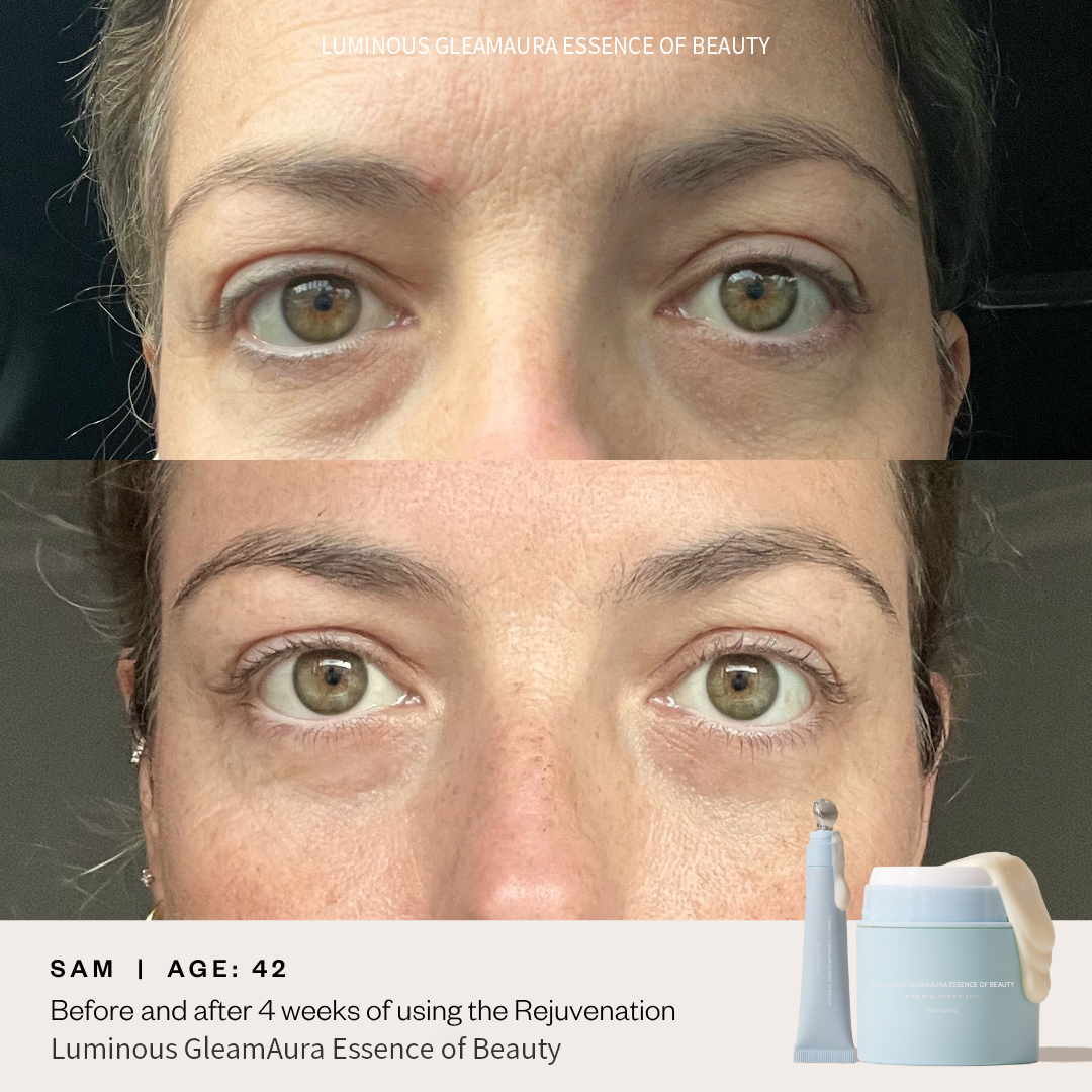 ⚡Luminous GleamAura Eye Cream: Brighten, Firm, and Revitalize Your Eyes⚡