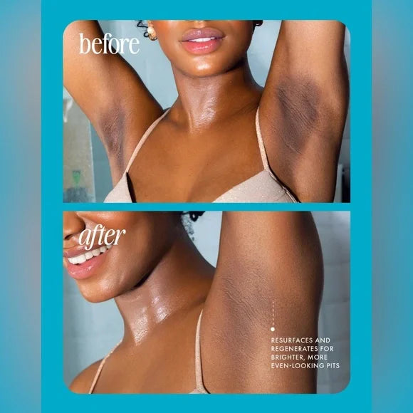 ⚡️ 5-Second Post-Hair Removal Rescue: Bumps Fade, Skin Glows! JELLY Smooth Oil.